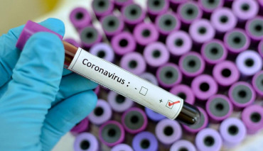 Akademisyenlerimiz Keçi Sütü İçerisindeki Bir Maddenin Koronavirüsten Korunmada Etkili Olduğunu Keşfetti